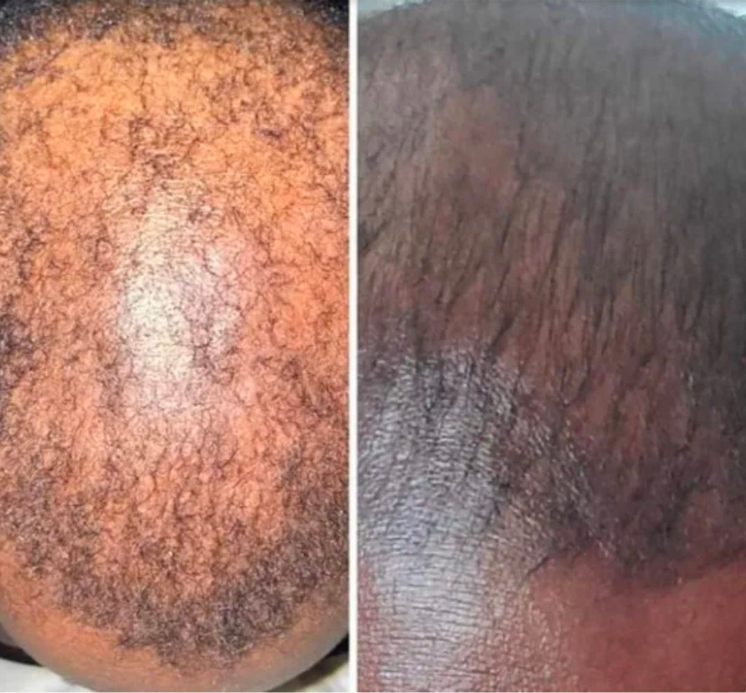 Growth Blend with Rosemary & Lavender